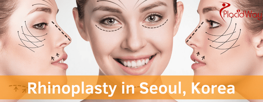 Rhinoplasty in Seoul Korea